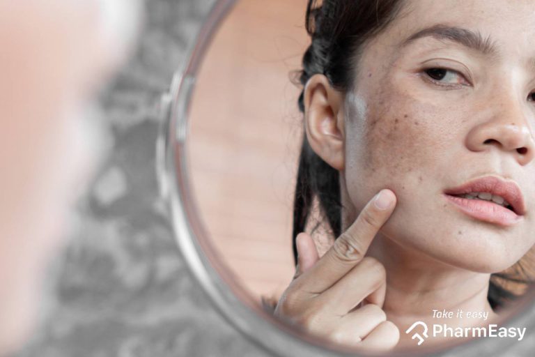 Best Ways to Reduce Dark Spots On The Face